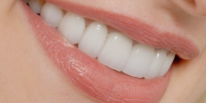 لامینت های دندانی
