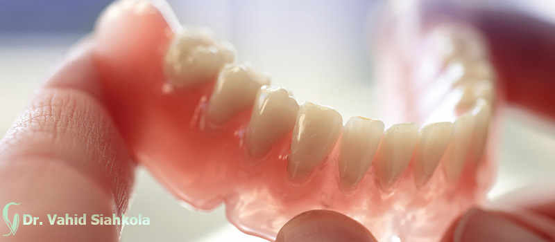 پروتز-متحرک-دندان