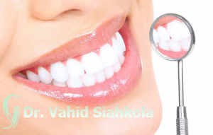 عوارض سفید کردن دندان چیست