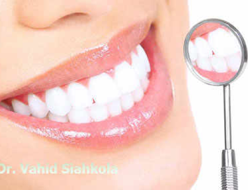 سفید کردن دندان و راه های پزشکی برای رسیدن به آن