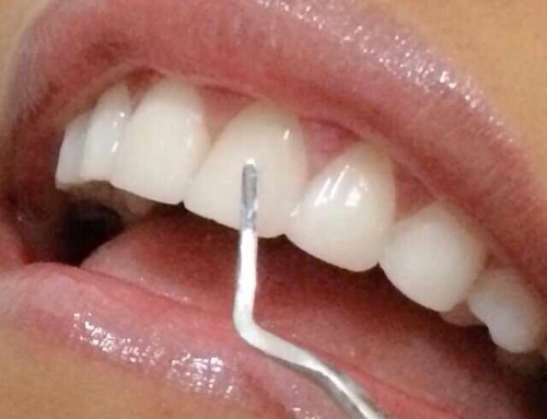 با دندانپزشکی زیبایی لبخندی هالیوودی داشته باشید!